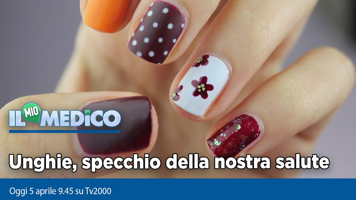 Oggi #5aprile a @medicotv2000 
🔹#unghie, specchio della nostra salute
🔹il neurostimolatore che permette di camminare dopo una lesione midollare
🔹l'alimentazione contro l'#obesità

Il Mio Medico, ore 9.45 su #Tv2000 
#salute #medicina