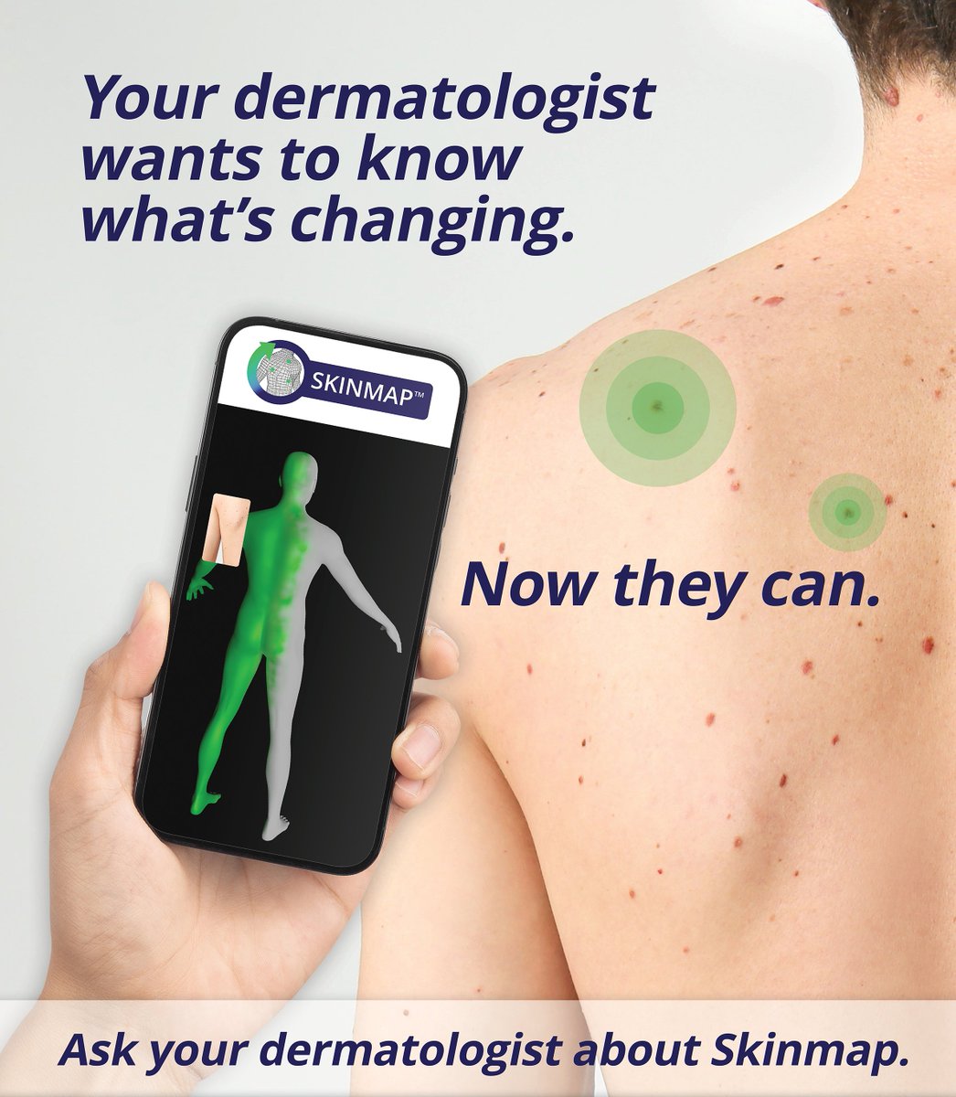 Experience Total Body Photography in 60 seconds with #Skinmap! Complete a Skinmap in one minute to see skin changes - a key prognostic indicator of skin cancer. Learn more about how Skinmap is #DigitizingSkinToSaveLives #ScanIn60Seconds @TriangulateLabs