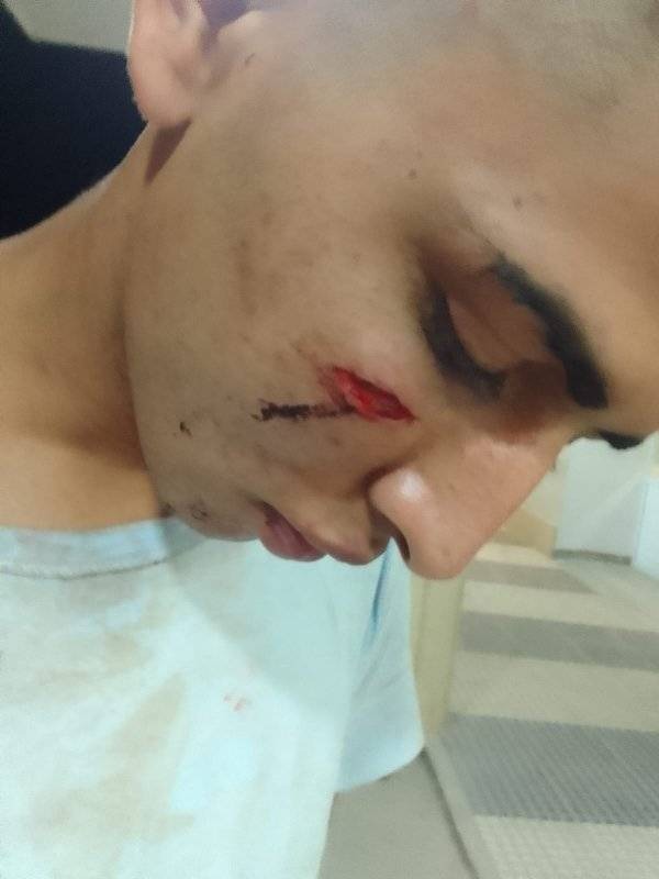 cesarJuarez10's tweet photo. 👉 Baile Malaba - San Andrés

🔴 Así quedo el joven agrediendo por personal de ¿seguridad? del local.

🚨 Ojo con ese baile...ojo.. siempre hay peleas de hombres y mujeres.
No todos los que concurren van a pelear https://t.co/X92mzv4K0N