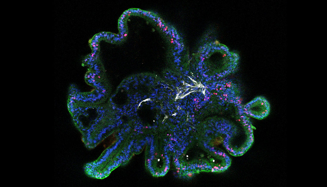 Want more control over your PSC cell populations for downstream differentiation? 📝 Take note of our new protocol and learn how to prepare single cells for use in intestinal #organoid differentiations: bit.ly/43BeQm4