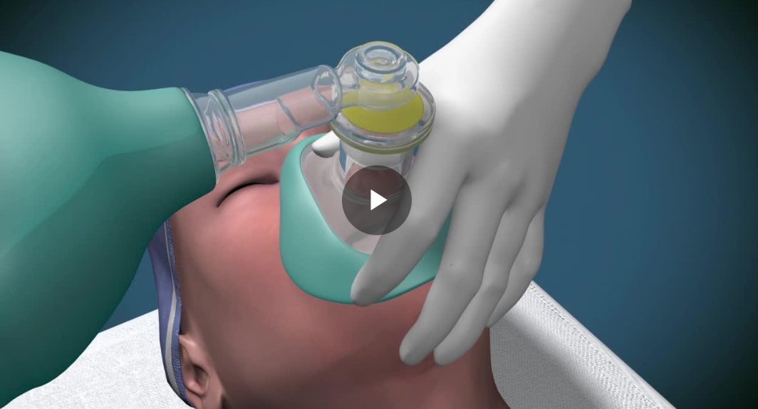 Refresh your memory with our videos on common clinical procedures🧠 Start with our demonstration video on 'Bag-valve-mask ventilation'. Videos include a list of equipment, complications, indications, contraindications and aftercare 👇 bit.ly/3PBQfYu