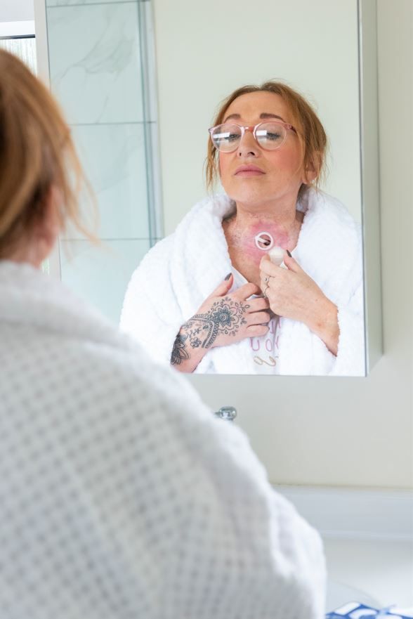 Navigating #skin care around a stoma can be a challenge for patients post-laryngectomy, especially when it comes to managing adhesives. Our latest blog offers practical, step-by-step guidance aimed at minimising irritation & enhancing comfort. Read more buff.ly/3PtclMM