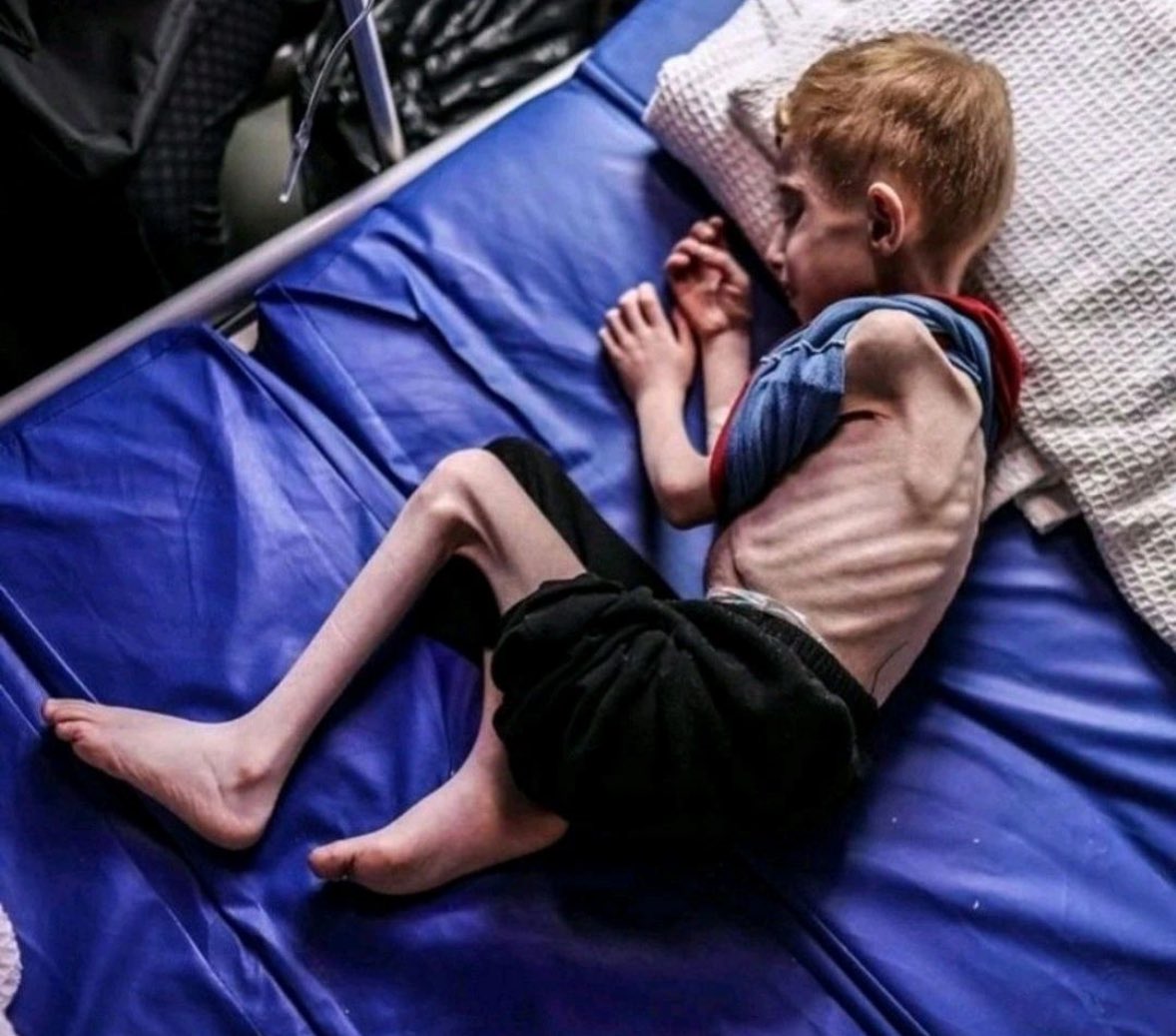Timesofgaza's tweet photo. Did you know?

The recommended calorie intake for a healthy child is 2100 calories per day. 

A report by Oxfam reveals that children In Northern Gaza are being forced to survive on 245 calories per day. https://t.co/eRRzEg3cnE