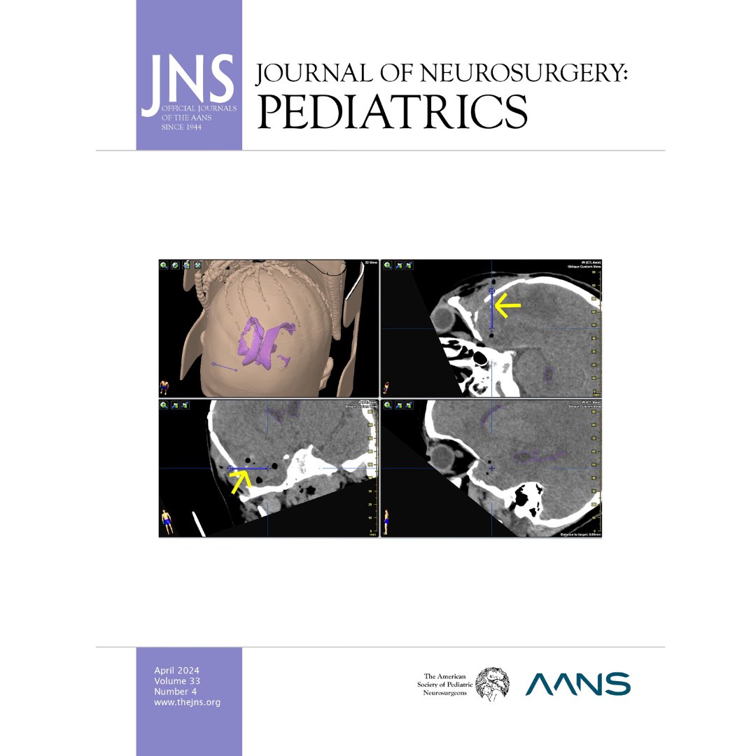#BWHCoverFeature: Congratulations to @jbernstock1 and team on landing the cover feature of @TheJNS Pediatrics. #NeurosurgeryResearch #Pediatrics