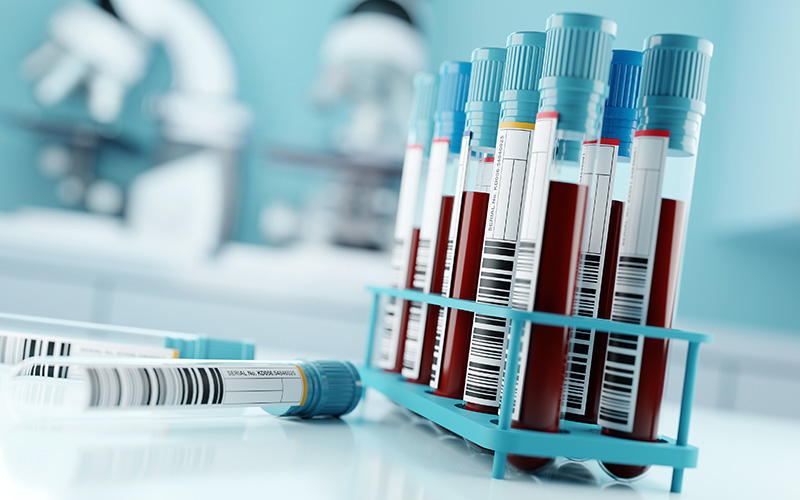 A team of researchers including Prof @jmschott @uclh @AlzResearchUK @UCLIoN & Dr @AshviniKeshavan @UCLBrainScience will carry out UK trials to identify accurate blood tests that can diagnose dementia, alongside @UniofOxford @alzheimerssoc & @NIHRresearch ucl.ac.uk/news/2024/apr/…