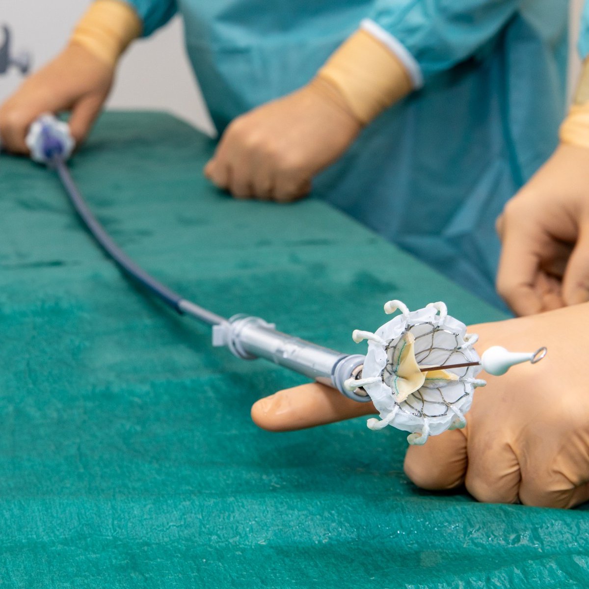 Vorige week is voor het eerst in de Benelux bij een patiënt in het St. Antonius Hartcentrum de hartklep tussen de rechterkamer en rechterboezem in het hart (de tricuspidalisklep) vervangen door een kunstklep. Hier was geen openhartoperatie voor nodig. antoniusziekenhuis.nl/nieuwsoverzich…