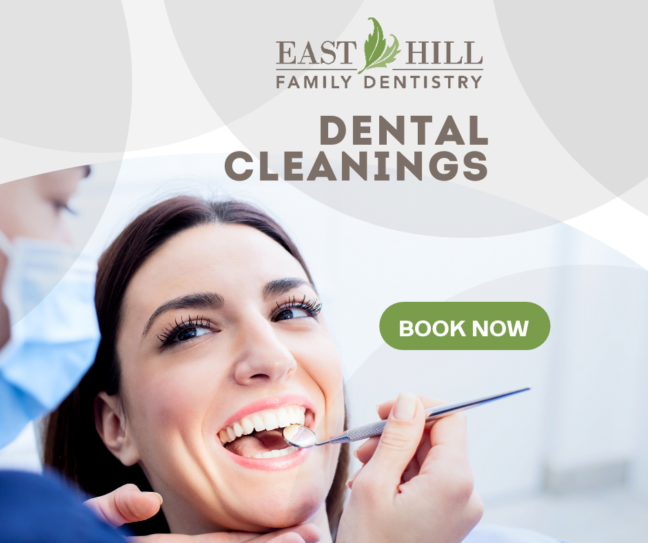 Has it been more than a little while since you last had your teeth cleaned? Our hygienists will look after you. Call our friendly dental clinic to schedule your dental hygiene appointment. bit.ly/3UjYMP7 #dental #hygiene #dentalcleaning #bellevilleontario #bayofquinte