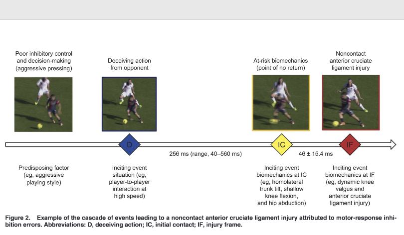 🆕'The most frequent non contact ACL injury was related to pressing, during which the opponent made a deceiving action, which suggested poor inhibitory control of the defender' 👉Alli Gokeler @F__Tosarelli @m_buckthorpe @FDellaVilla 2024 📂Open Access: meridian.allenpress.com/jat/article/59…