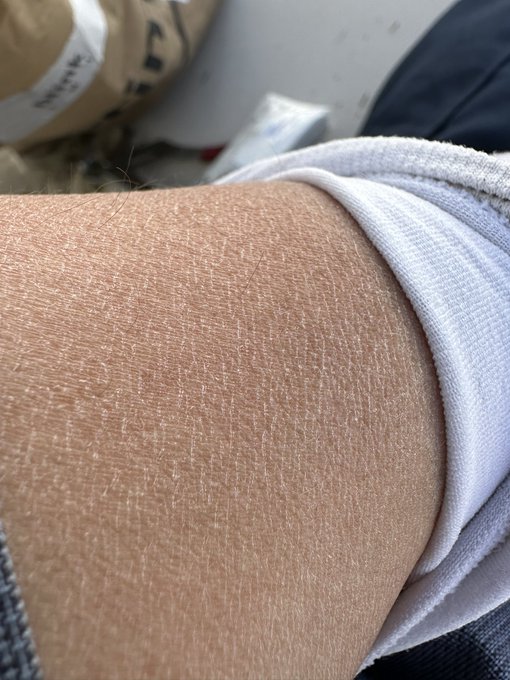 Fuck am I weathered. Not used to the dryness of the desert. Gotta moisturize and drink more water. https://t<a href="/tag/mvsales"class="tags"><span>#mvsales</span></a>