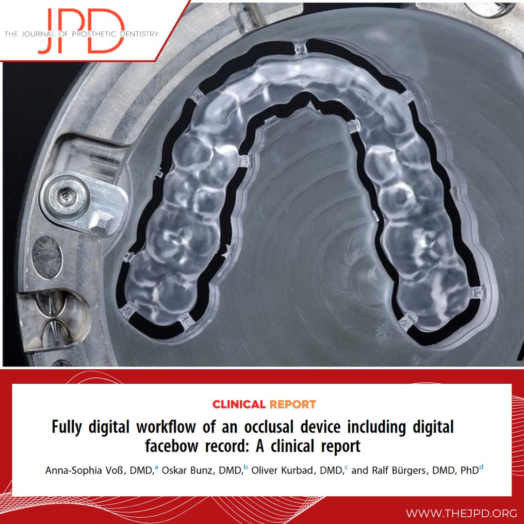 JPDentistry's tweet image. In this #dentaltechnique, a simple scannable #facebow assembly is incorporated into #intraoralscans to avoid arbitrary virtual articulation and additional and expensive armamentarium: thejpd.org/article/S0022-…