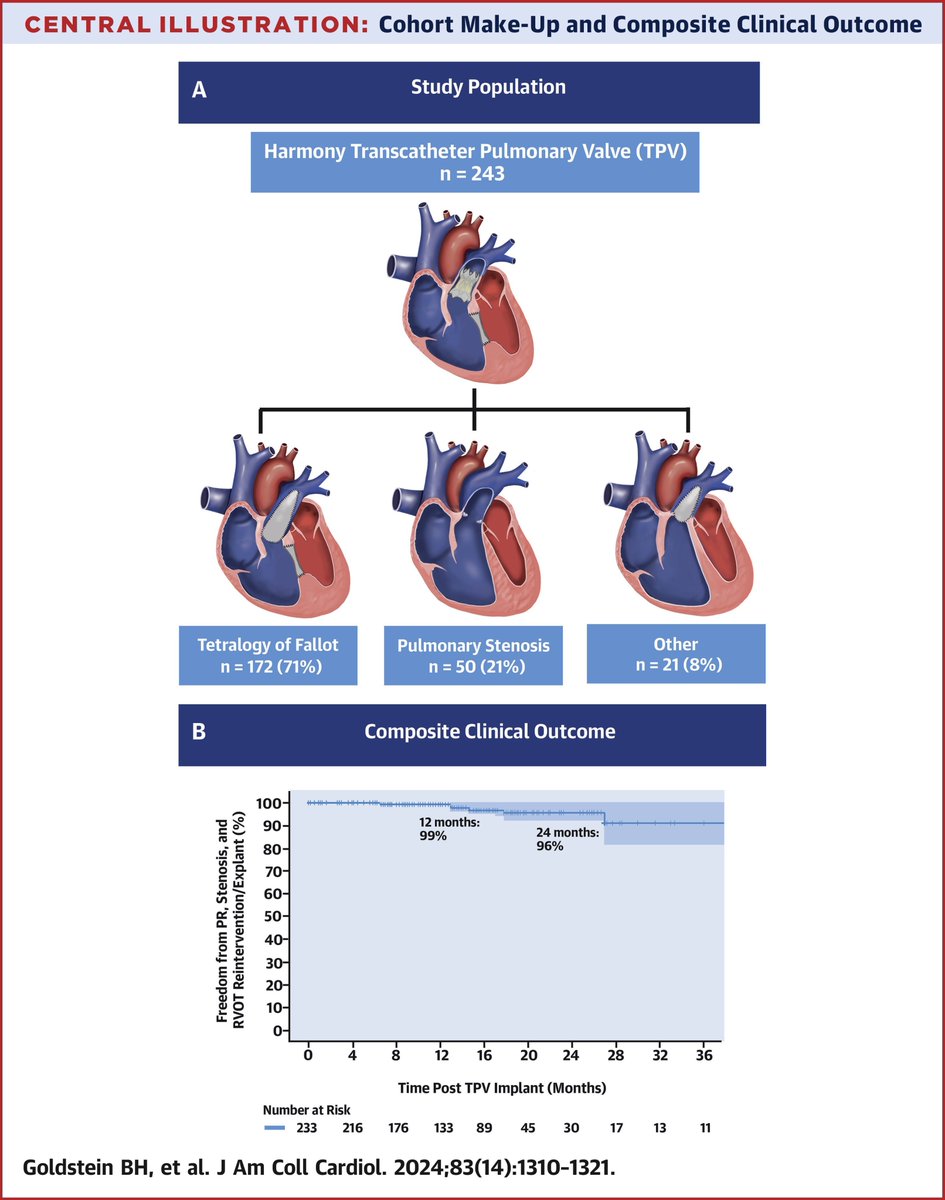 Exciting new article! New published research shows early outcomes of pts with ≥moderate PR receiving the Harmony self-expanding TPVR. With 99% freedom from AEs at 1 year, the TPVR demonstrates promising results in addressing RVOT dysfunction. Read  here: tinyurl.com/2ky52hvv