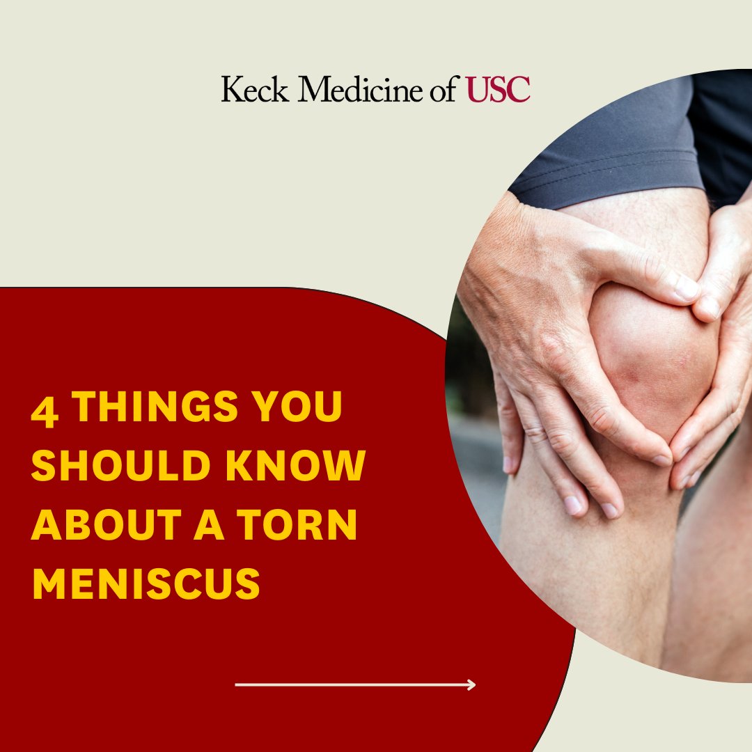 KeckMedicineUSC's tweet photo. Experiencing knee pain? The culprit could be a torn meniscus! Learn the 4️⃣ things you should know about this common injury. 👇
#tornmeniscus #kneepain https://t.co/o36LUtHmxY