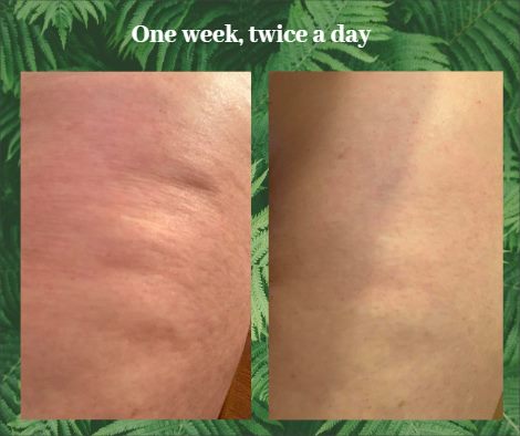 lisainsocal's tweet image. Get poolside ready with our Sunless Tanner and Tone &amp;amp; Firm Lotion!
#toned #sunlesstan #tanning #HealthySkin #firming #PoolParty #swimmingpool #beachlife #beachday 
bit.ly/45PIGTr