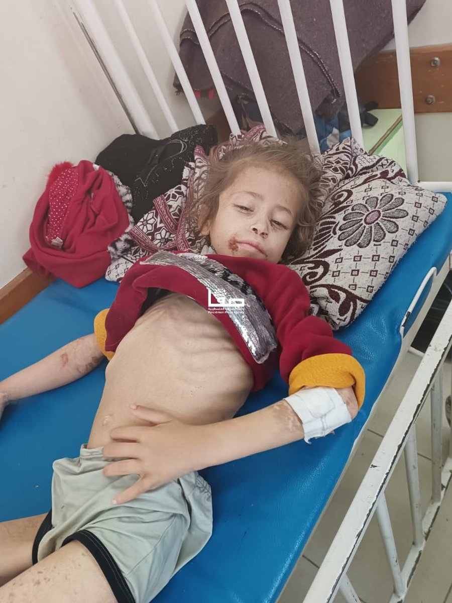RamAbdu's tweet photo. Heartbreaking: The mother of the Palestinian girl Jana Ayad cries as her daughter's condition deteriorates due to hunger and dehydration caused by the severe Israeli blockade on northern Gaza. https://t.co/9GIJbpAN8w