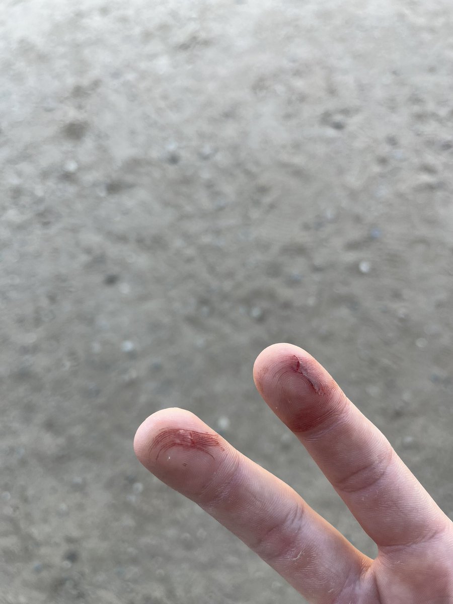 Anyone have any tips for dealing with blisters/small cuts on fingers for pitchers? 

Esoteric health community I need yall to show out on this one: