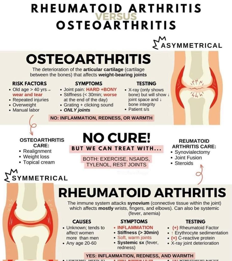 Rheumatoid Arthritis Vs Osteoarthritis Subscribe 👇 youtube.com/@pgmedicine2023