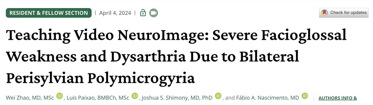 Great work by Drs. Zhao and Paixao reporting a case from our @WashUNeurology Epilepsy Transition Program. @washuepilepsy @GreenJournal @BarnesJewish @STLChildrens neurology.org/doi/pdf/10.121…