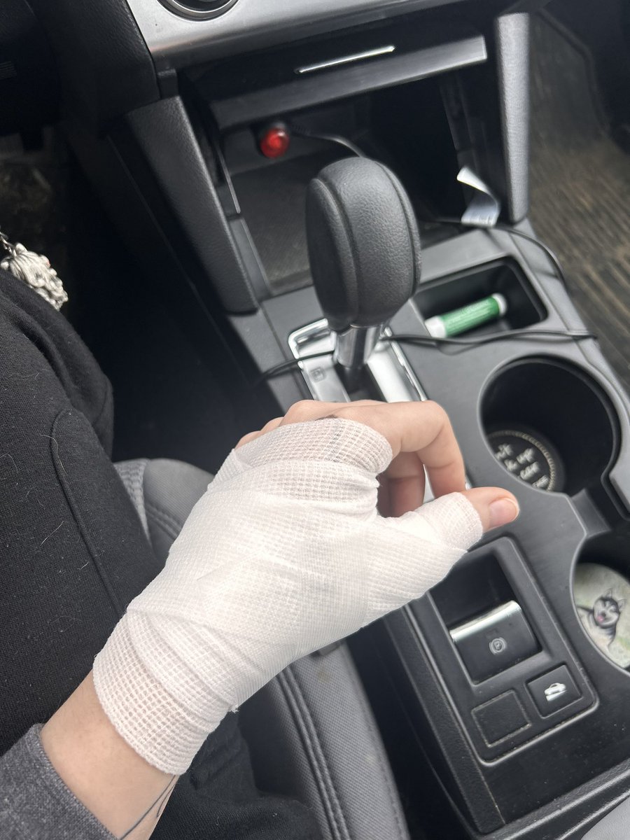 JocieMarks's tweet photo. my hand is now wrapped from the cat bite. I’m also on antibiotics https://t.co/v4EjaRgudC