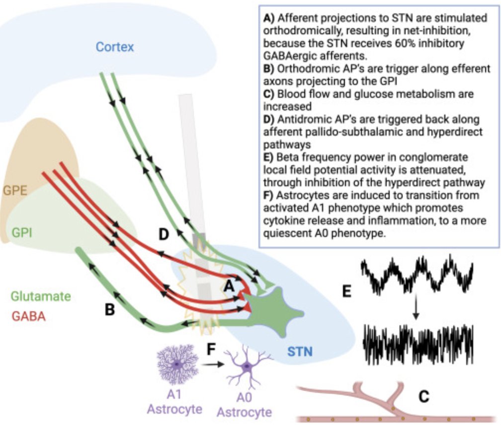 For a brief review of the mechanisms underlying DBS, take a look at our recent review! @kalialabs @lukamneuro authors.elsevier.com/sd/article/S18…