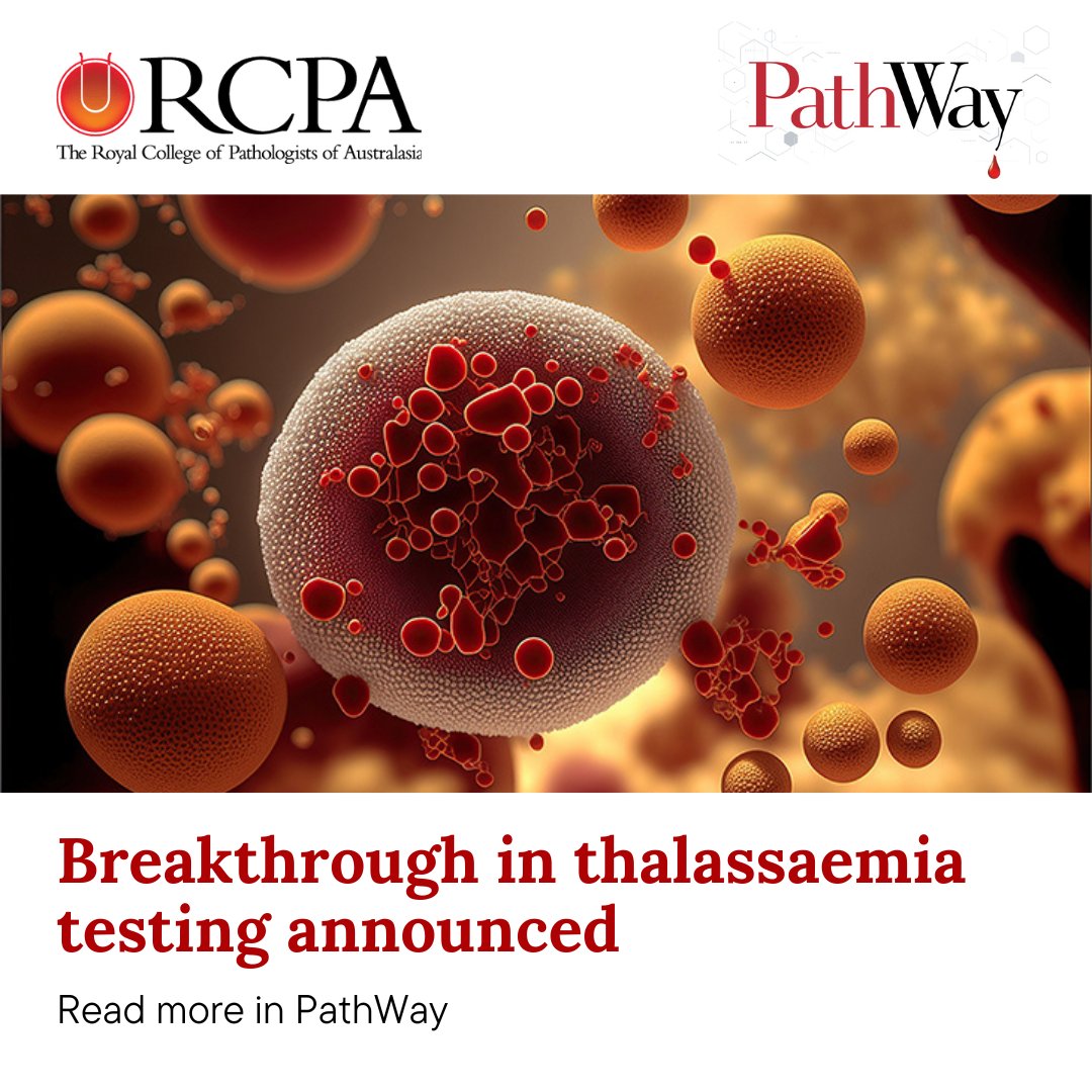 A significant advancement in #thalassaemia testing has been unveiled by haematologists Dr Niles Nelson & Dr Yasar Zirek. The breakthrough test could reduce the processing time for thalassaemia testing & lower costs to process the test. #PathWay rcpa.me/PathWayThalass…