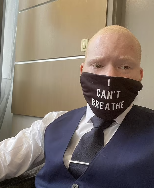 CollinRugg's tweet photo. NEW: "World's sexiest albino" & BLM activist Tyree Conyers-Page charged with fraud & money laundering.

At this point we should just be asking: Who involved with BLM *wasn't* doing something illegal?

According to prosecutors, Page used George Floyd's death to raise a whopping $500,000 that he used on himself instead of BLM causes.

The albino allegedly used the money to purchase himself guns, suits and a home.

Page setup a GoFundMe posing as Black Lives Matter of Greater Atlanta and raised half a million dollars from 1,000 donors.

Remarkable.