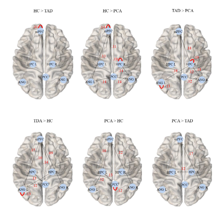 📢Preprint alert📢 Seda Sacu (not in twitter) led this work in collaboration with @drcionucl colleagues 'Differential default-mode network effective connectivity in young-onset Alzheimer's disease variants' medrxiv.org/content/10.110… @jmschott @DrCFSlattery