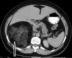 Diagnosis? Why? Management? Source: Cureus