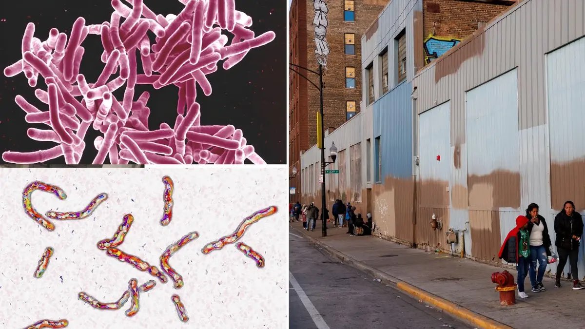 THIS WAS PREDICTED !!! “Tuberculosis breaks out at Chicago migrant shelters following measles cases” Chicago health officials announced that some tuberculosis (TB) cases have been reported at some migrant facilities following an outbreak of measles among migrants living in…