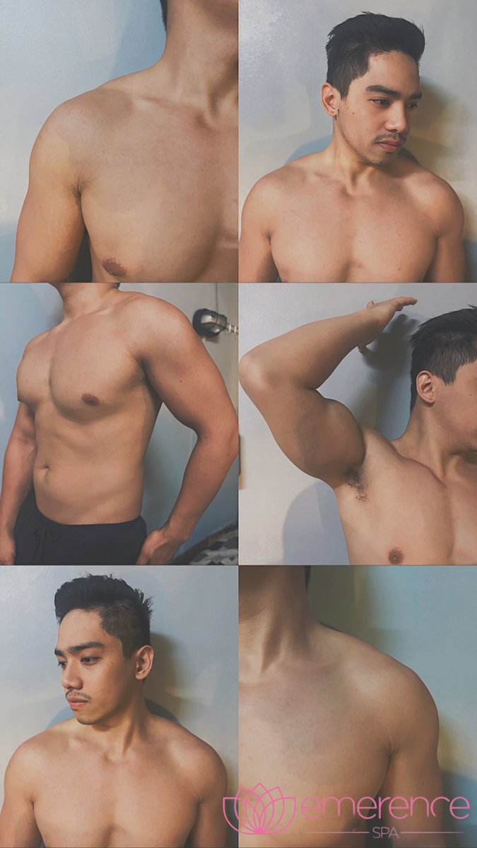 IamRaw_Bert's tweet photo. Experience the relaxing advantages of a massage without having to leave your house.
No need to run through traffic or wait in a busy lobbyβjust schedule your massage at a time that works for you.
Also open for outcall services from 2PM-2AM.
#EmerenceMAX
@GersonOran83964 https://t.co/QonROSYj8u