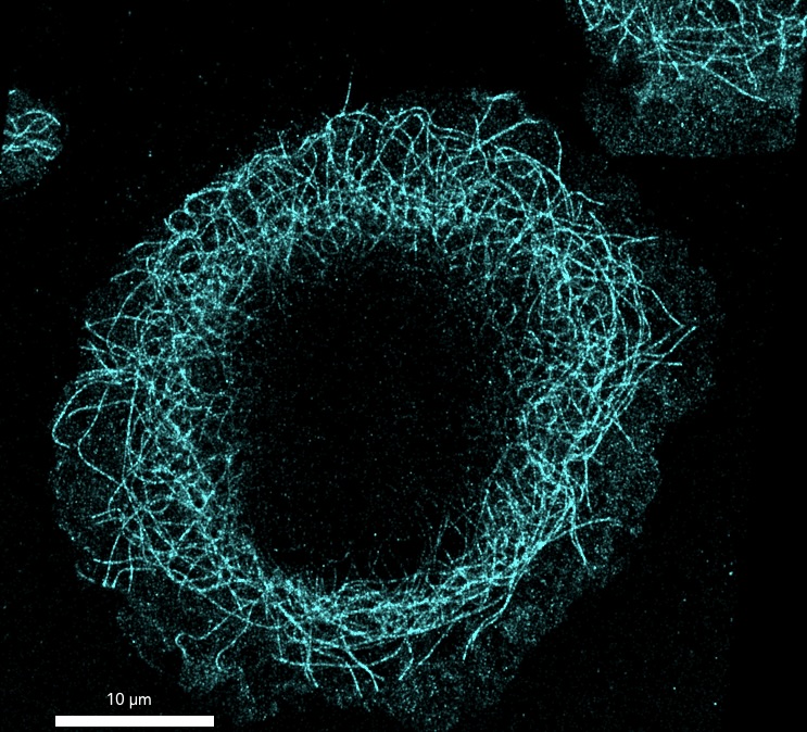 oniHQ's tweet photo. 🔬It's Fluorescence Friday and we have an image of tubulin in macrophages, taken by Dr. Megan Palmer from the Goethe-Universität Frankfurt a Main, with support from ONI's Field Application Scientist Dr Laura Woythe. 

#superresolution #microscopy #DiscoveryKit #FluorescenceFriday https://t.co/jex7x7VfAI
