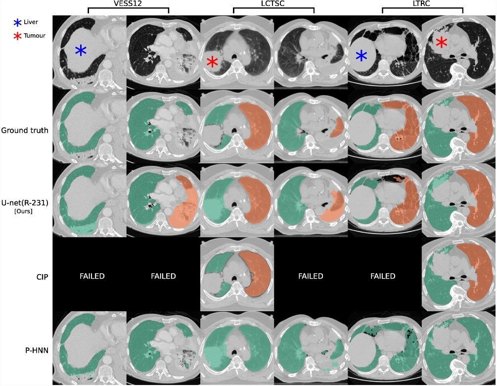 European Radiology (@eurradiology) on Twitter photo ๐ฅ The most cited 2023 #EuropeanRadiologyExperimental article compared four #DeepLearning approaches trained on various datasets related to lung segmentation, illustrating importance of data diversity. (<a href="/joh_hof/">Johannes Hofmanninger</a> et al., <a href="/georg/">Georg Langs</a>, <a href="/contextflow_rad/">contextflow</a>)
Kudos!
๐buff.ly/43c5M5d ๐ฅ The most cited 2023 #EuropeanRadiologyExperimental article compared four #DeepLearning approaches trained on various datasets related to lung segmentation, illustrating importance of data diversity. (<a href="/joh_hof/">Johannes Hofmanninger</a> et al., <a href="/georg/">Georg Langs</a>, <a href="/contextflow_rad/">contextflow</a>)
Kudos!
๐buff.ly/43c5M5d