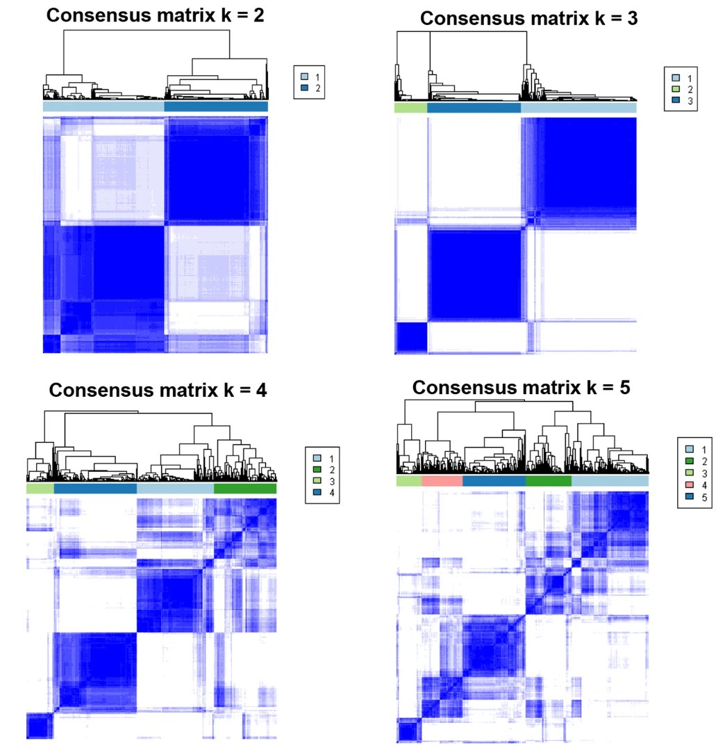 Phenotypic subtypes of fibrotic #HypersensitivityPneumonitis identified by machine learning consensus #ClusterAnalysis Physiologic pulmonary function pattern contributes a high value to clustering. #pulmonaryfibrosis #fibroticILD respiratory-research.biomedcentral.com/articles/10.11…