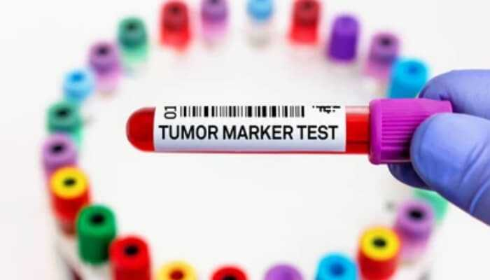 syedRes78322802's tweet photo. Preparing For Your First Cancer Marker Test
#CancerMarkerTest #FirstScreening #HealthCheckup #CancerAwareness #Medical #DiseasePrevention #Knowledge @TycoonStoryCo @tycoonstory2020 @AmericanCancer @medlineplus
https://t.co/fPBZ5RjviB https://t.co/BefCiJ0GCG