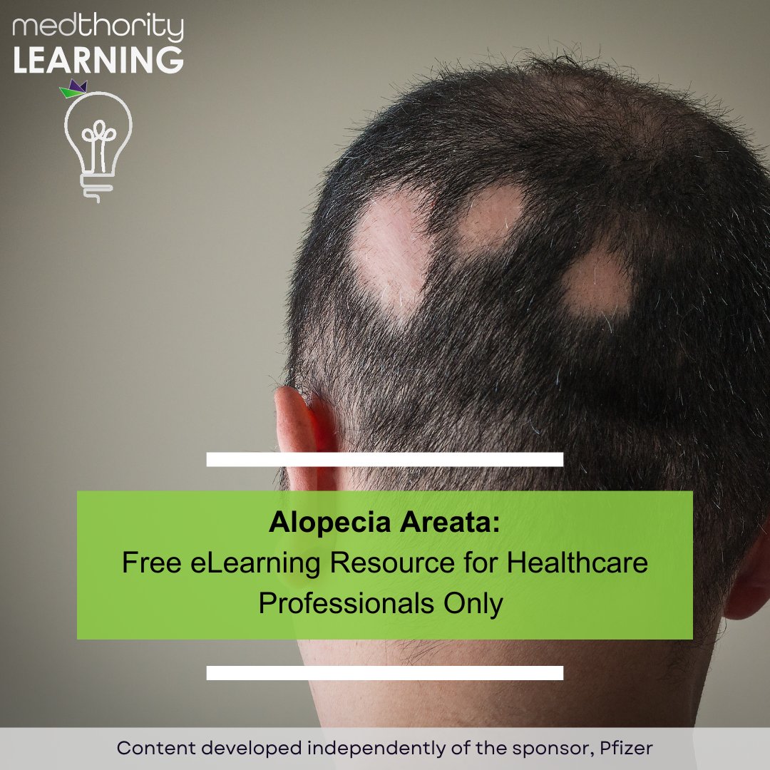 Access highlights from AAD 2024 and stay up-to-date with developments in alopecia areata (AA) from predictors of treatment response to the psychosocial needs of patients on Medthority. ➡️ ow.ly/9Nst50R3ovG #MedTwitter #NurseTwitter #CME #IME #MedEd #Alopecia #HCP