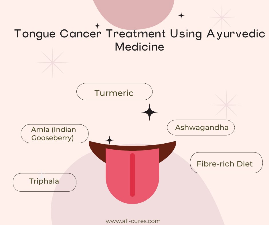 #tonguecancer #ayurveda 
Tongue Cancer Treatment Using Ayurvedic Medicine
all-cures.com/cure/4431-Tong…