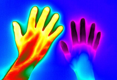 This article references Raynaud’s:  The triggers (cold and stress), the symptoms (color changes and pain) and the two forms (primary and secondary). bit.ly/3ojb3G4 #raynaudssyndrome #research #coldhands