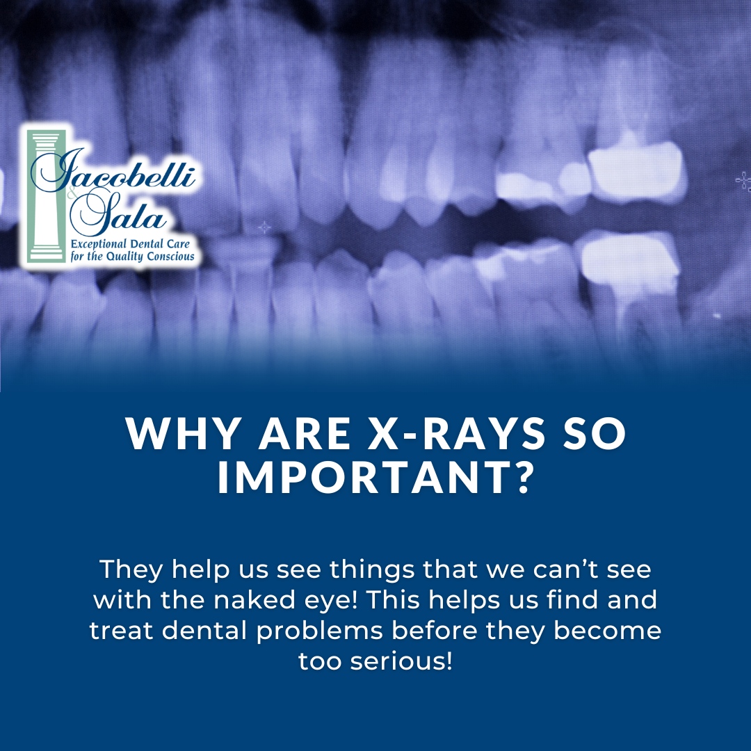 X-Rays are one of the most essential parts of any dental treatment. Our X-Rays are perfectly safe and will help us treat any issues before they get too serious or painful! 

#IAS #IacobelliandSala #dentist #ohio #greatercleveland #Strongsville #BroadviewHeights #NorthRoyalton