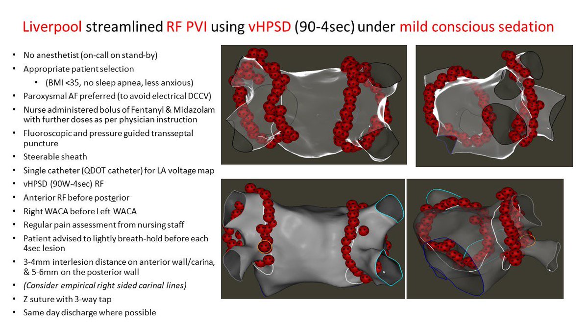 #EPeeps – is GA/deep sedation available for every AFib ablation in your centre? 🤔 …No❓ We discuss our “@LiverpoolEP Streamlined Approach” to RF PVI under mild conscious sedation using 90W/4sec #QDot @BiosenseWebster Now online open access @JCardioEP doi.org/10.1111/jce.16…