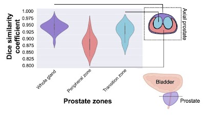 #DeepLearning for prostate MRI segmentation showed comparable accuracy to expert radiologists doi.org/10.1148/ryai.2… @becker_rad @adithyabala_med @swoo_rad #prostate #ML #MachineLearning