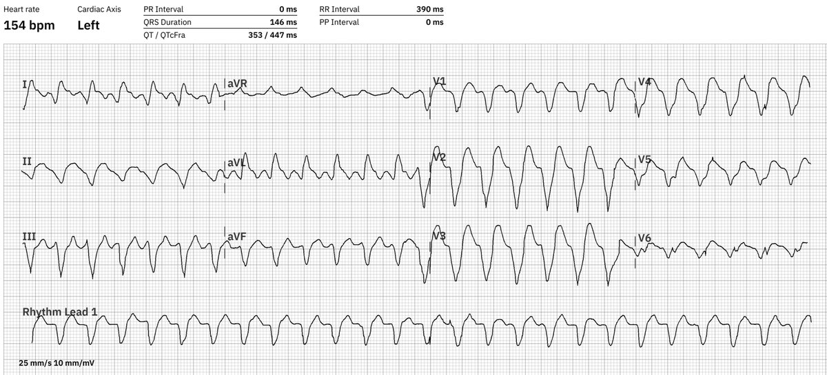 We want to practise recognizing where the arrhythmia comes from; diagnosis? origin?