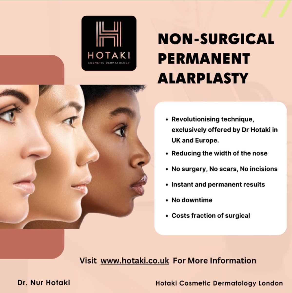 #drhotaki #hotakilondon #nonsurgicalaesthetics #aesthetictreatment #hotakicosmeticdermatology #noninvasive #nonsurgical #nonsurgicalpermanentalarplasty #nonsurgicalalarplasty #alarplasty
