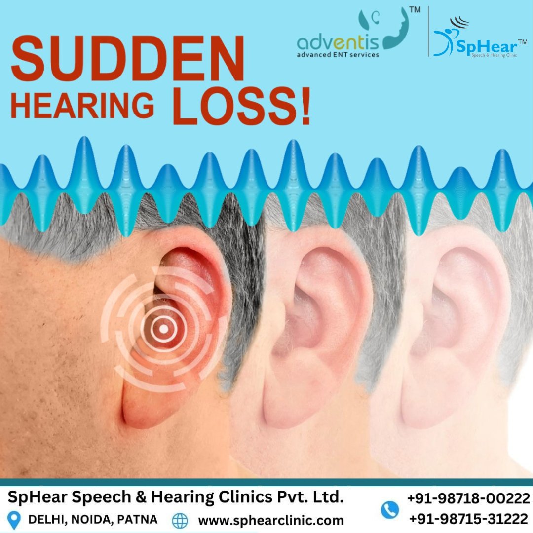 Sudden hearing loss, marked by muffled sounds, ear fullness, and speech comprehension issues, requires immediate medical attention to minimize long-term effects and preserve hearing. 👉🔗 bit.ly/3i0rBhi 
#sphear #sphearclinic #clinic #SuddenHearingLoss  #HearingLoss