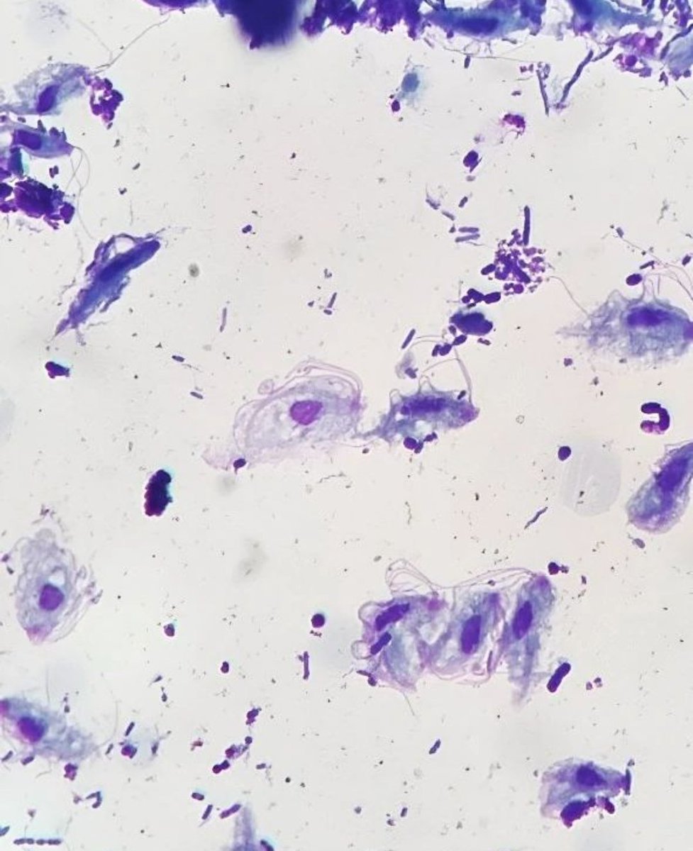 mICROBIOsh's tweet photo. Trichomonas spp. 💜 
Coloración Diff-Quick 🎨

📸:IG: laboratoria_micromir https://t.co/RQjklZ6RQr