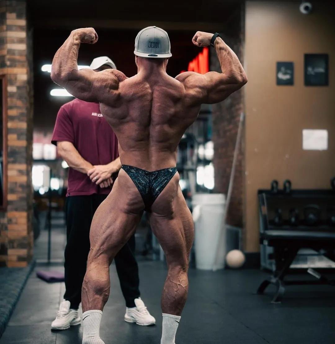 Harris Harris Shows Us His Current Condition At 48h Outside The Detroit Pro. Your Coach Martin Winston.