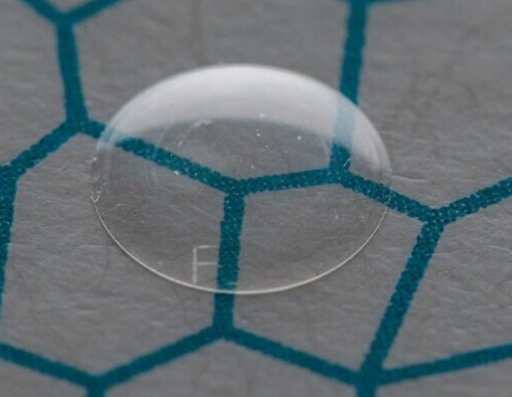 Impressive results with the EndoArt artificial corneal endothelium in this complex case where 3 previous endothelial tissue transplants failed. Vision improved from hand movements to 6/24 in 48 hours. Promising technology for the treatment of #Fuchsdystrophy <a href="/oclvision/">OCL Vision</a>