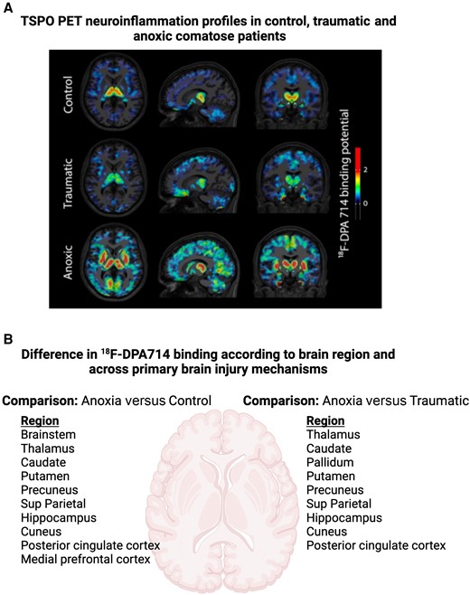 Neuroinflammation is a player in coma, but in which role? New scientific commentary by Olli Tenovuo & David J Loane tinyurl.com/ftswa9u8