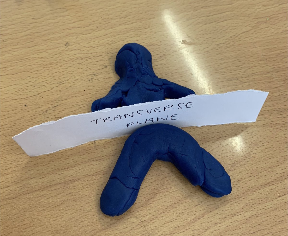 ShipstonPEDept's tweet photo. An excellent number of students at revision tonight. The focus was movement analysis, so students used their creative skills to demonstrate the different planes and axes.
👍👏
#greatsession
#component1 https://t.co/K52H7LzBBq