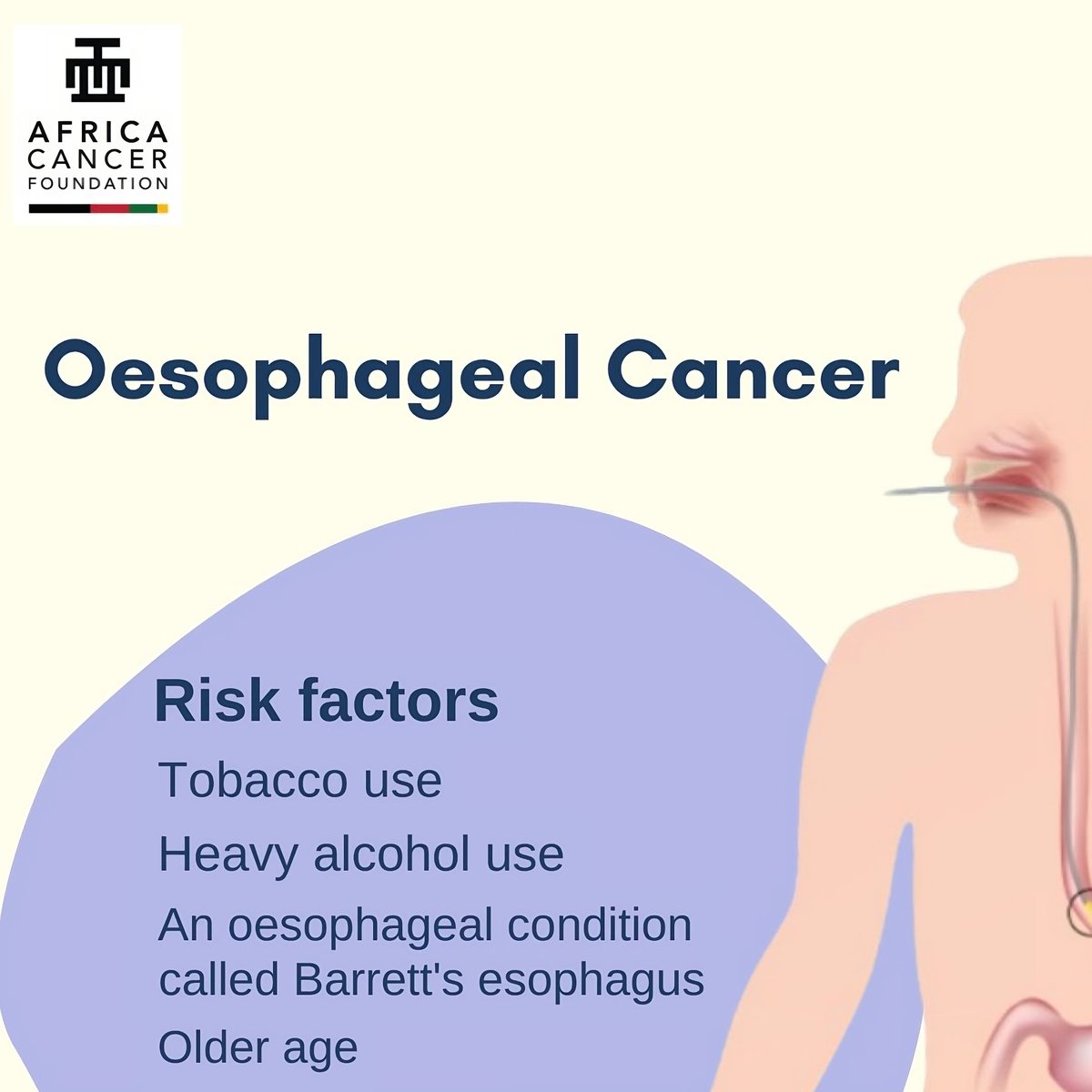 Smoking, heavy alcohol use, and Barrett oesophagus can increase the risk of #oesophagealcancer. #ACancerFreeAfrica #BecauseWeCare