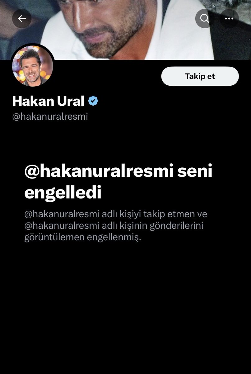 Hakan Ural'ı versek Naylon Leğen Eder mi🤭😂🥳🤪 Hakoşşş İNCİNMİŞ 👀🪡