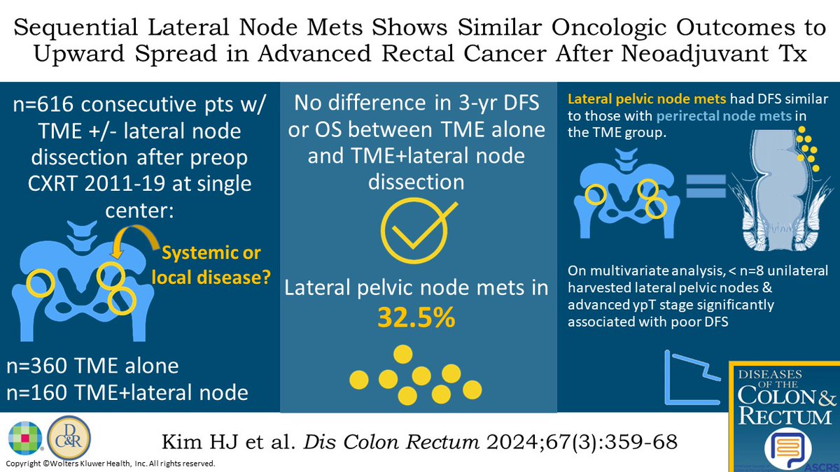 #DCRJournal visual abstract | Sequential Lateral Lymphatic Metastasis Shows Similar Oncologic Outcomes to Upward Spread in Advanced Rectal Cancer After Preoperative Chemoradiotherapy: bit.ly/3VJ7HOx

@ScottRSteeleMD @Swexner @me4_so @ACPGBI @drtracyhull @ASCRS_1